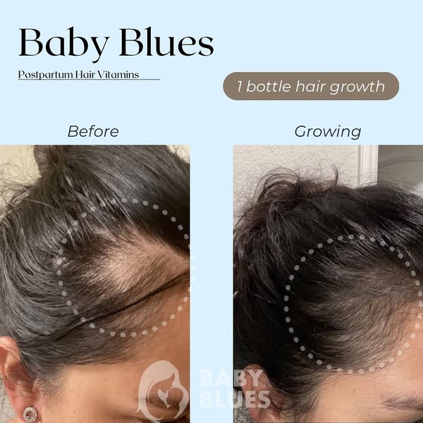 Postpartum Hair Loss Vitamins with Biotin & Collagen | Baby Blues