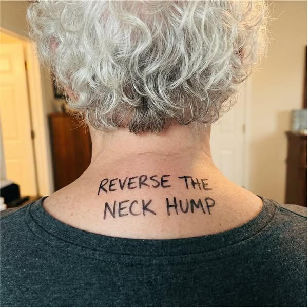 7 signs your neck hump is worse than you think